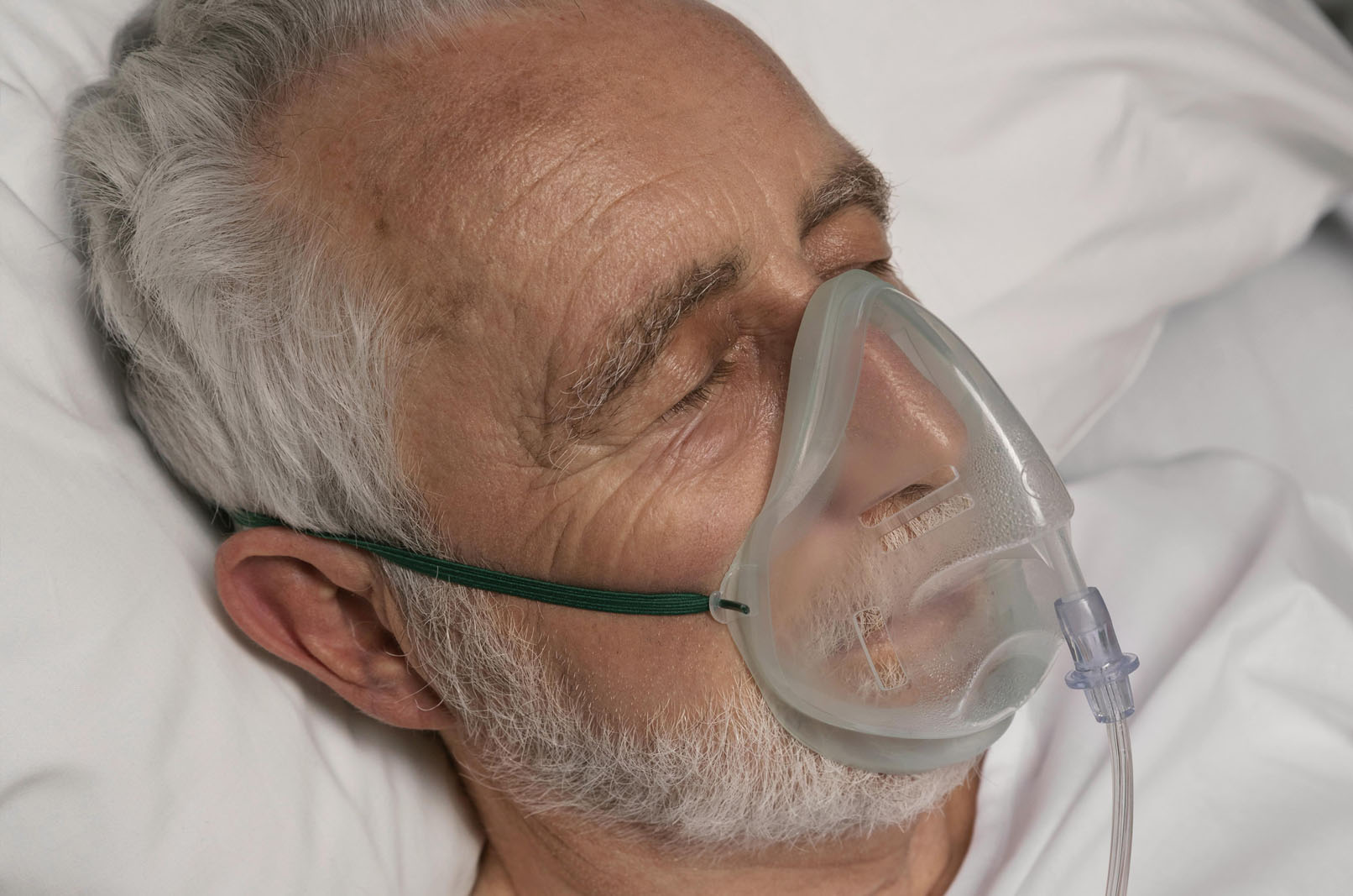 Sleep Apnea